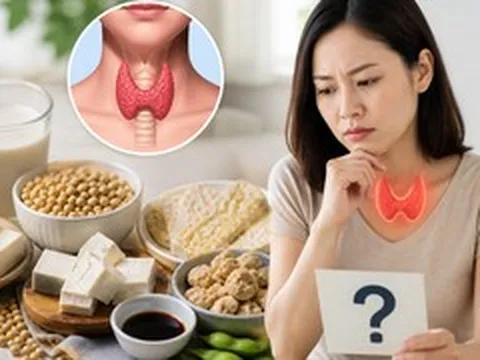 Người bị bệnh tuyến giáp có phải kiêng các sản phẩm từ đậu nành?