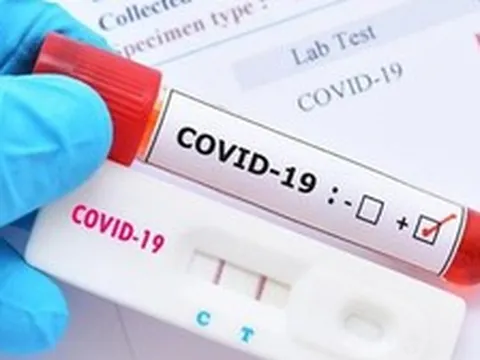 NÓNG:  83% mẫu COVID-19 tại TP HCM là biến chủng mới NB.1.8.1