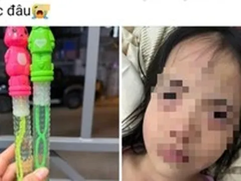Bé gái 5 tuổi tổn thương mắt sau khi thổi bong bóng xà phòng