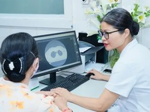 Đi khám miễn phí, hai người phát hiện nghi ung thư phổi dù không có triệu chứng
