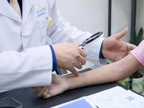 Cô gái phải đi khám gấp sau buổi đi bơi vì nổi mẩn đỏ khắp người