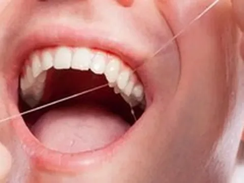 Lời khuyên cho những người sử dụng chỉ nha khoa hàng ngày