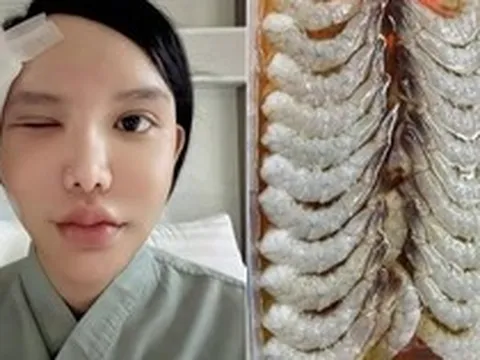 Người phụ nữ bị ký sinh trùng bò vào hốc mắt, suýt mù, bác sĩ cảnh báo 1 thói quen nhiều người Việt mắc phải