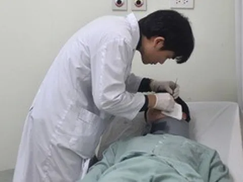 Tiêm filler ở spa, cô gái 24 tuổi nhập viện vì ổ áp xe sau 3 năm