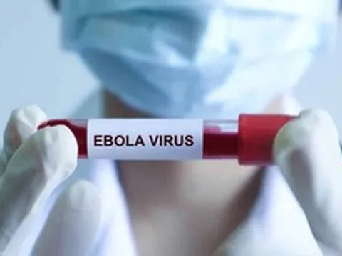 Bệnh Ebola tử vong đến 90%, Bộ Y tế ra chỉ đạo khẩn, yêu cầu cách ly nghiêm ngặt
