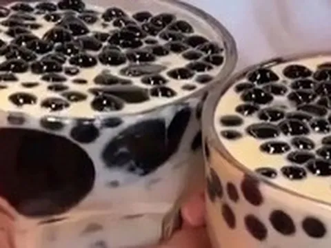 9 năm “nghiện” trà sữa thay nước lọc, uống tới 3.000 cốc: Người phụ nữ biến hai quả thận thành... túi đựng sỏi