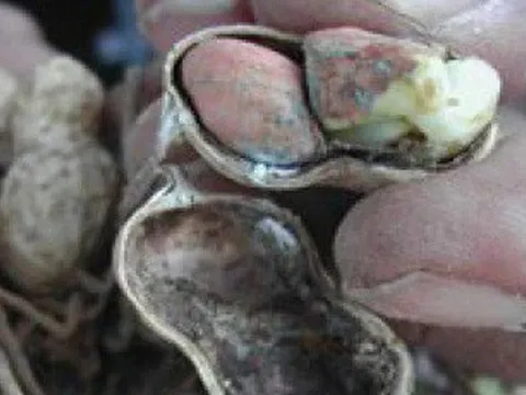 Loại hạt để mốc hại gan, "độc hơn thạch tín", nhiều người không biết vẫn vô tư ăn