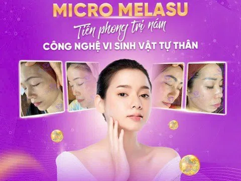 Chuỗi Viện Nám DR TRUNG LÊ: Nơi Mang Đến Giải Pháp Điều Trị Nám Tối Ưu